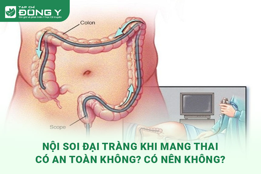 noi-soi-dai-trang-khi-mang-thai