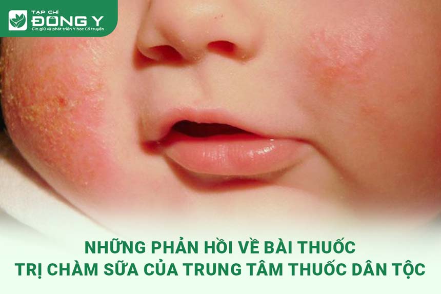 thanh-bi-duong-can-thang-dac-tri-cham-sua