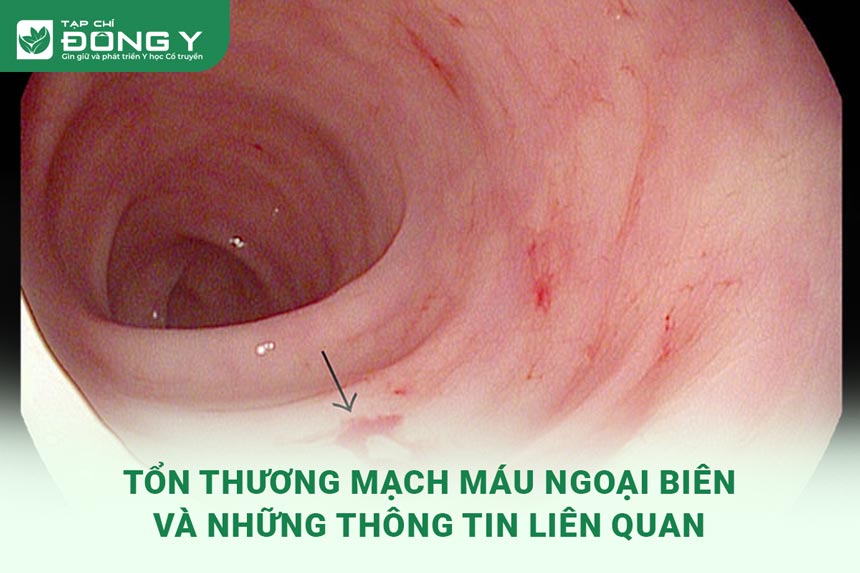 ton-thuong-mach-mau