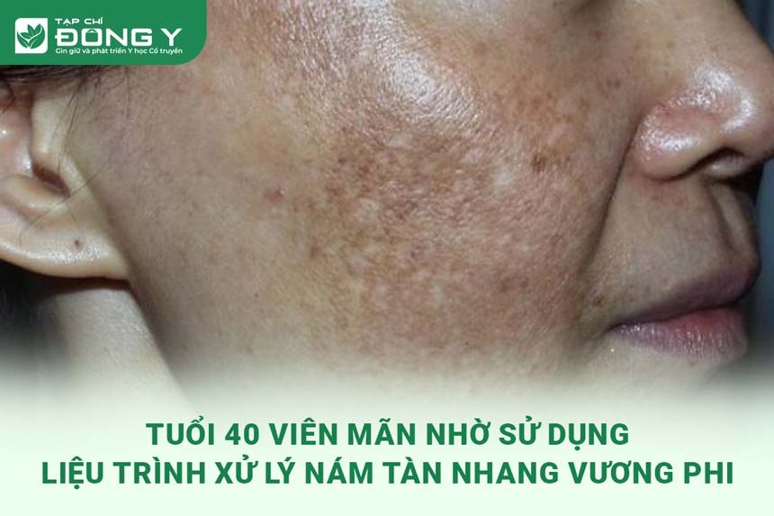 tuoi-40-vien-man-nho-bo-tri-nam-vuong-phi