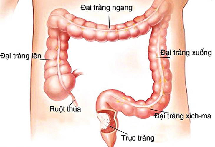 u-truc-trang