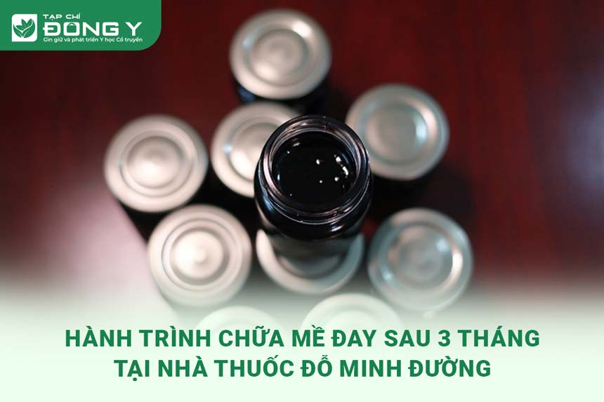 chia-se-kinh-nghiem-chua-me-day-tai-do-minh-duong