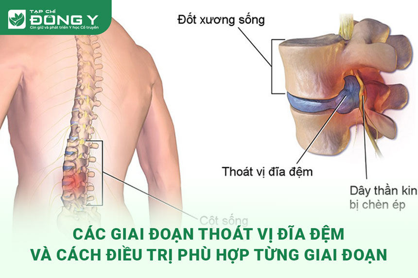 giai-doan-thoat-vi-dia-dem