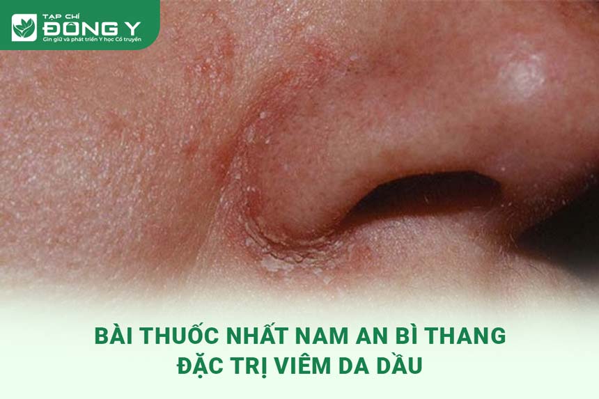 bai-thuoc-nhat-nam-an-bi-thang-dac-tri-viem-da-dau-tiet-ba-danh-gia-cua-nguoi-benh