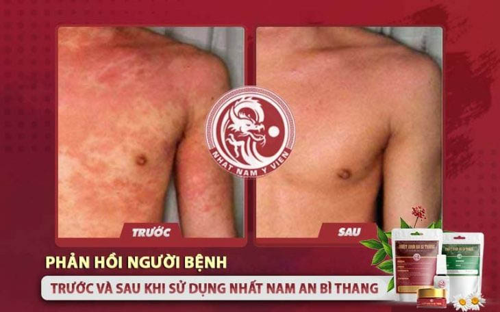 Hầu hết các phản hồi đều cho thấy bệnh nhân khá hài lòng với bài thuốc