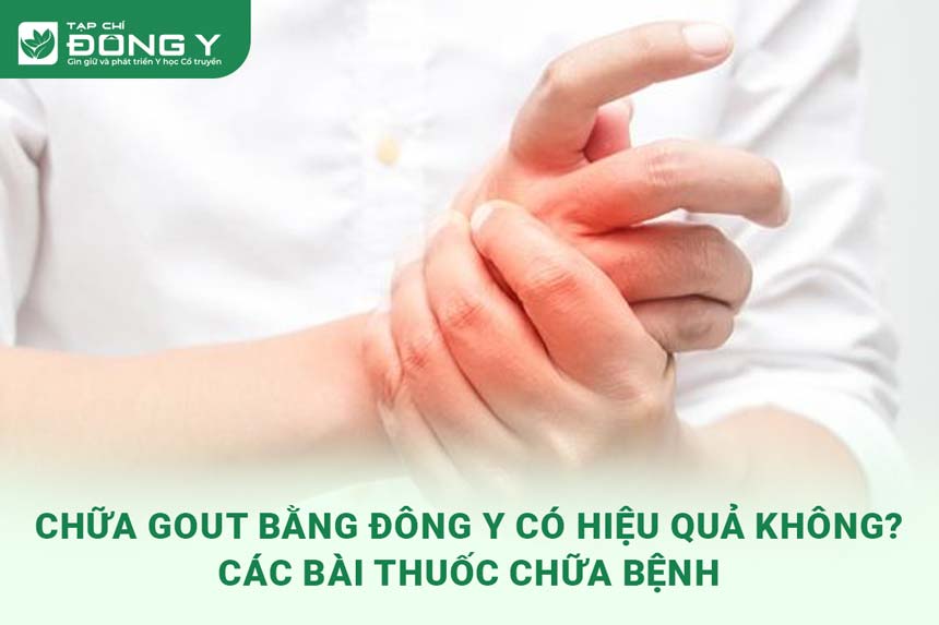 chua-gout-bang-dong-y