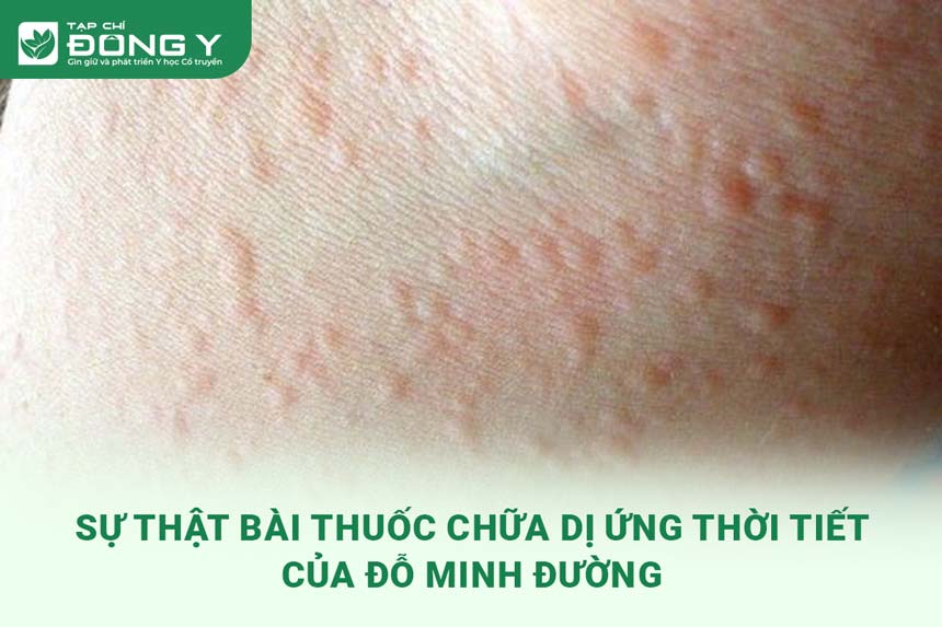 su-that-bai-thuoc-chua-di-ung-thoi-tiet-cua-do-minh-duong