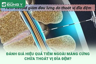 tiem-ngoai-mang-cung-chua-thoat-vi-dia-dem