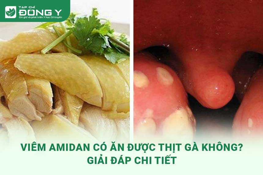 3. Chế Độ Dinh Dưỡng Sau Cắt Amidan