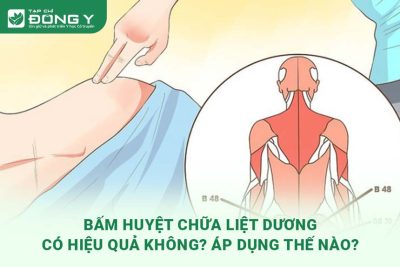 bam-huyet-chua-liet-duong