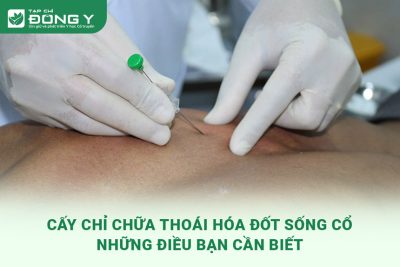 cay-chi-chua-thoai-hoa-dot-song-co