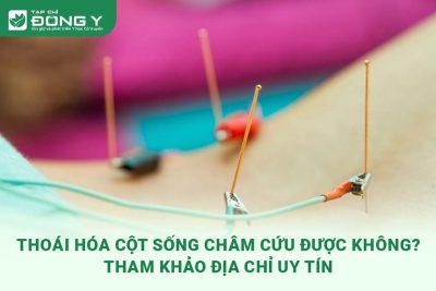 thoai-hoa-cot-song-co-cham-cuu-duoc-khong