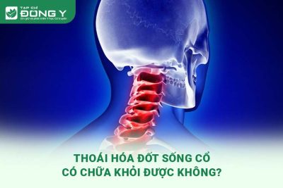 thoai-hoa-dot-song-co-co-chua-khoi-duoc-khong