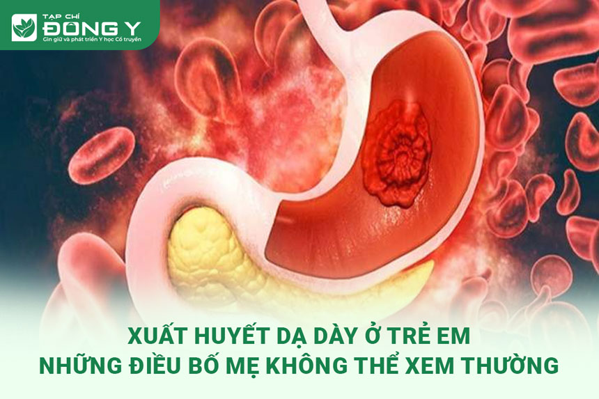 xuat-huyet-da-day-o-tre-em