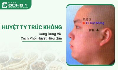 huyet-ty-truc-khong