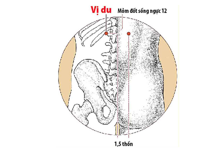 huyet-vi-du