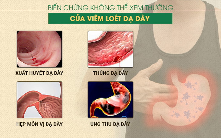 Biến chứng của viêm loét dạ dày tá tràng