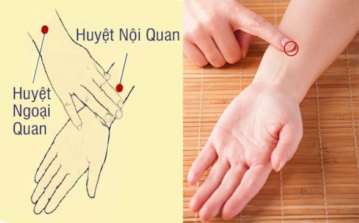 Vị trí huyệt Nội quan