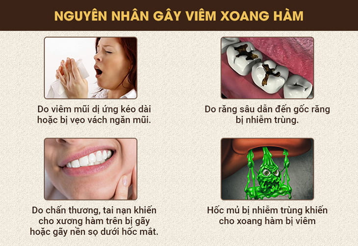 Các nguyên nhân gây viêm sưng tổn thương tại xoang hàm