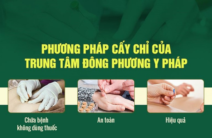 Cấy chỉ giảm béo là phương pháp an toàn, hiệu quả