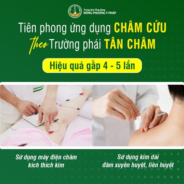 Đông Phương Y Pháp tiên phong ứng dụng châm cứu theo Trường phái Tân Châm mang lại hiệu quả điều trị gấp 4 - 5 lần