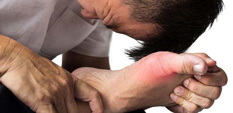 Gout gây đau đớn dữ dội