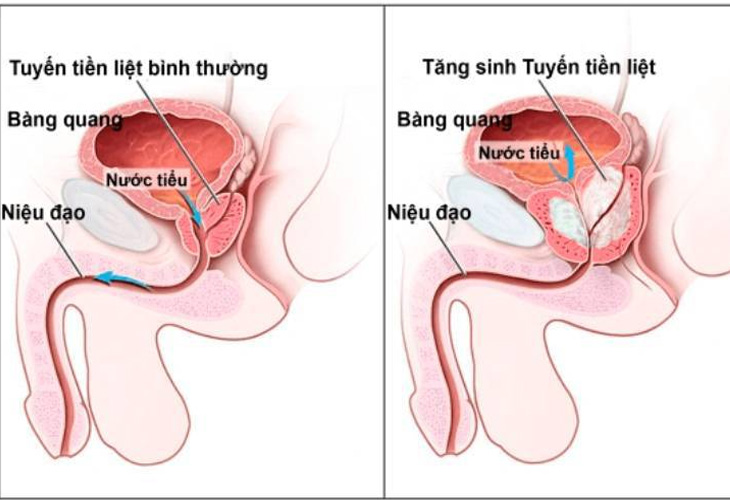 dau-bung-duoi-sau-quan-he-1-ngay