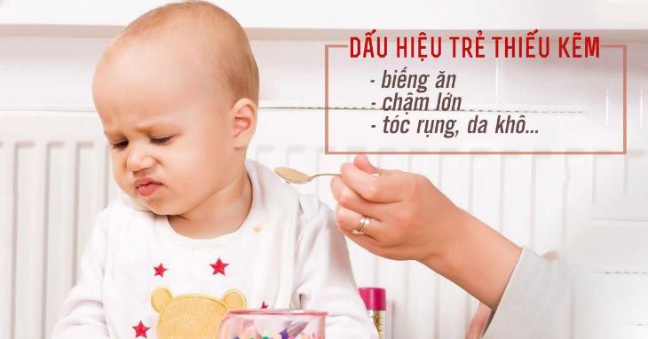 Trẻ thiếu kẽm thường có biểu hiện chán ăn, khó ngủ