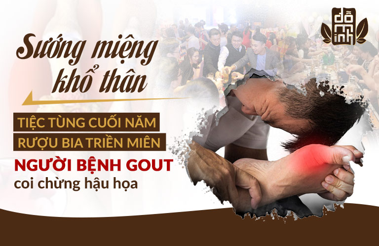 Người bệnh gout thường phải "trả giá" cho những lần nhậu "tới bến"