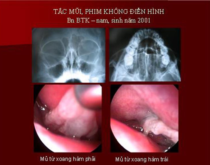 Hình ảnh mô tả cụ thể các biểu hiện của bệnh lý