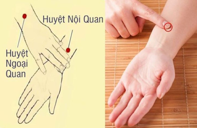 Huyệt nội quan