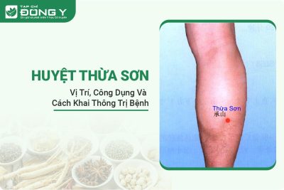 huyet-thua-son