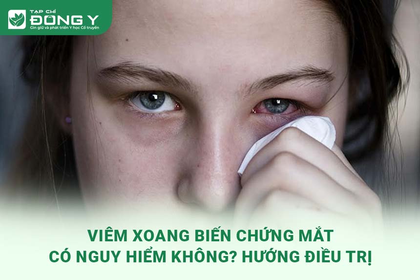 viem-xoang-bien-chung-mat