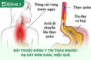 thuoc-dong-y-tri-trao-nguoc-da-day
