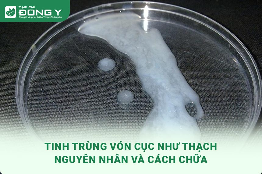 tinh-trung-von-cuc-nhu-thach