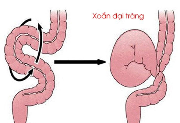 xoan-dai-trang