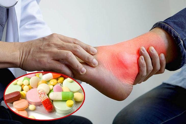 Tìm hiểu về các loại thuốc gout tốt nhất hiện nay