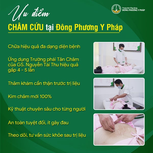 Ưu điểm khi châm cứu tại Đông Phương Y Pháp