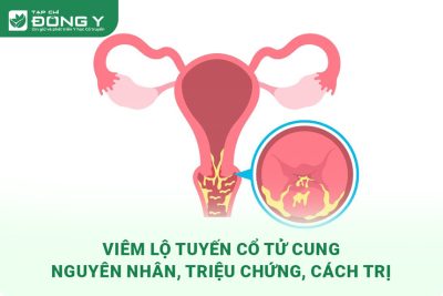 viem-lo-tuyen-co-tu-cung