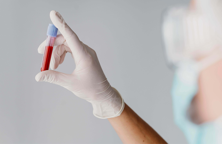 Xét nghiệm máu chỉ định khi nghi ngờ các bệnh lý toàn thân liên quan