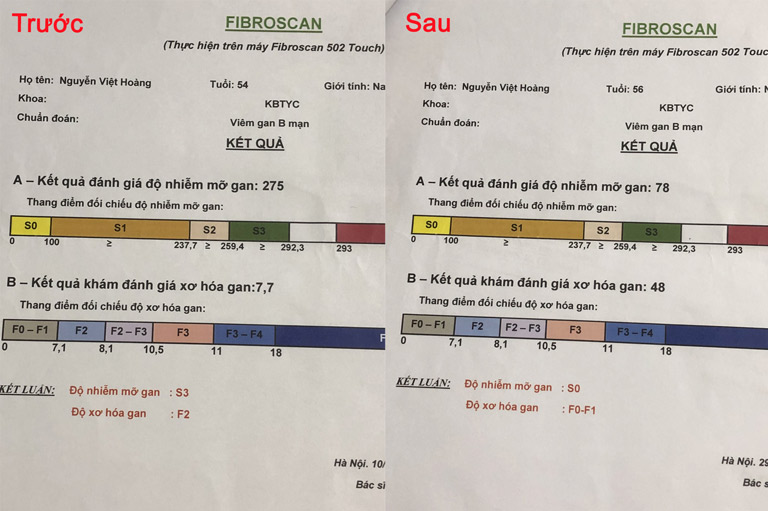 Kết quả kiểm định trước và sau điều trị của bệnh nhân Nguyễn Việt Hoàng