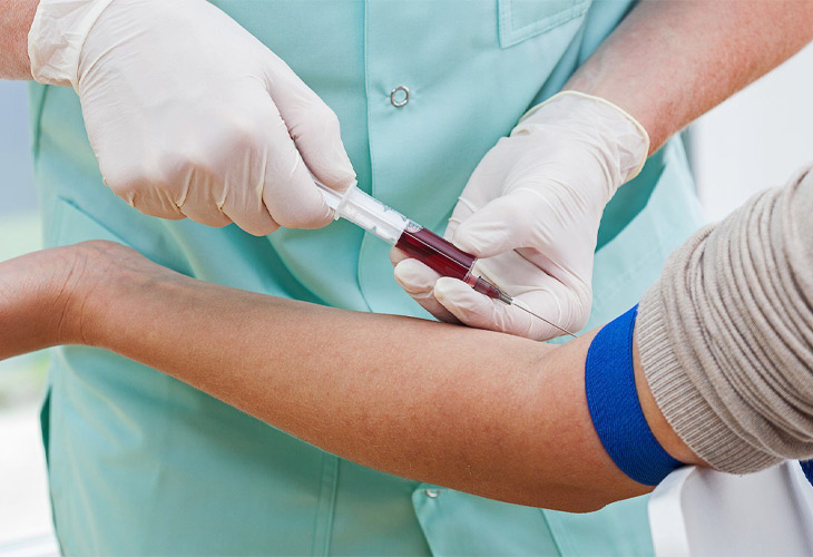 Tiến hành các xét nghiệm máu để loại trừ các bệnh lý khác
