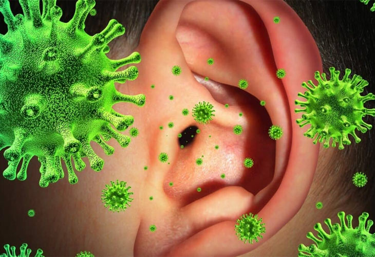 Vi khuẩn, virus có thể là nguyên nhân gây viêm tai giữa ứ dịch