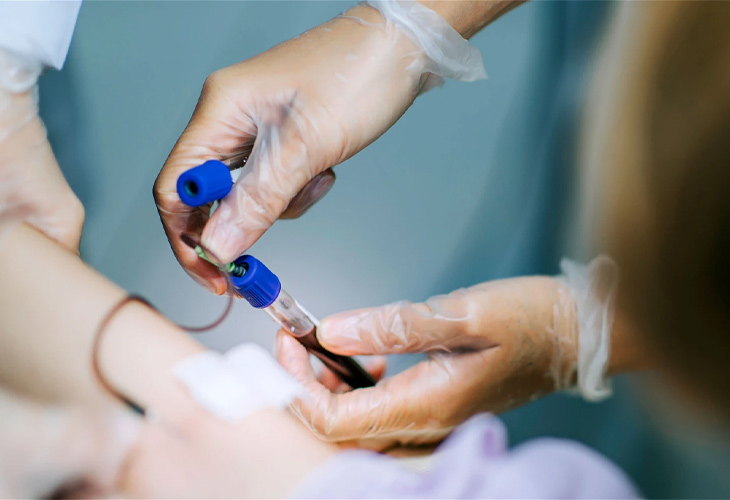Xét nghiệm máu có thể được chỉ định để chẩn đoán bệnh