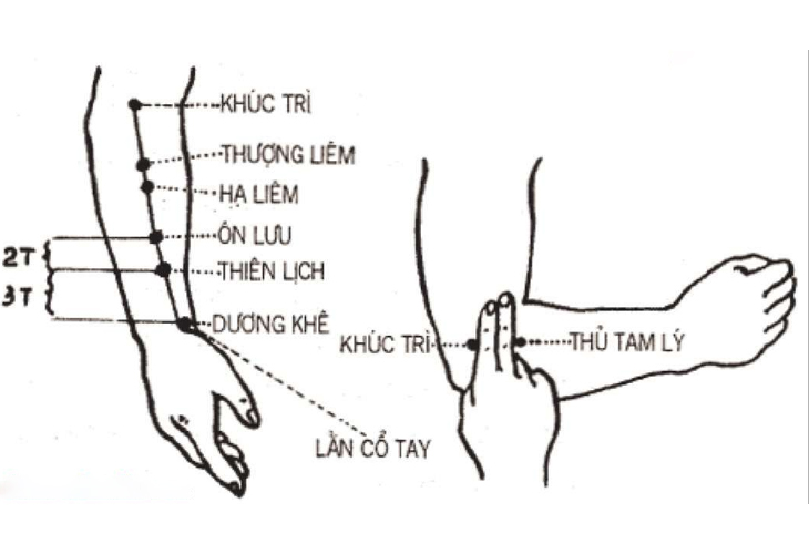 Thiên Lịch nằm trên mặt trước cẳng tay, mặt ngoài, cách lằn chỉ cổ tay 2 thốn