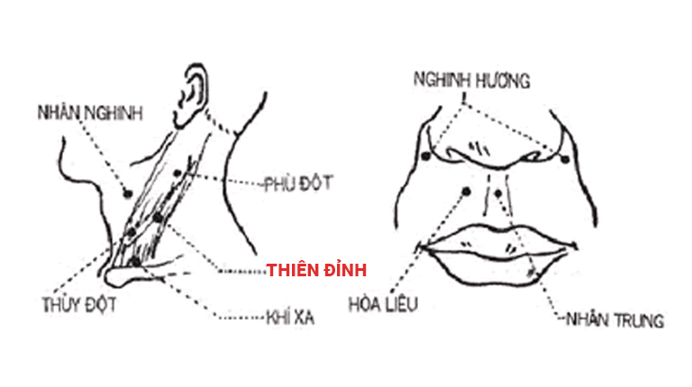 Huyệt Thiên Đỉnh nằm ở vùng cổ, thuộc cơ ức đòn chũm