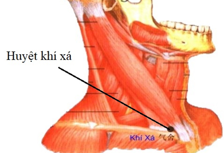 Phối hợp với huyệt Khí Xá cải thiện hiệu quả bệnh viêm họng