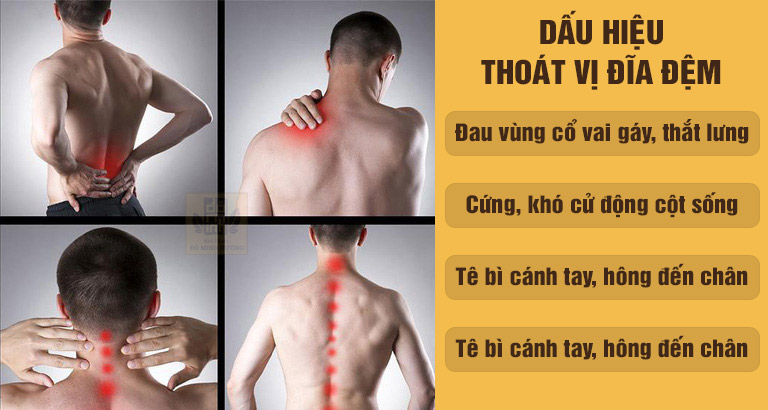 Dấu hiệu thoát vị đĩa đệm thường gặp