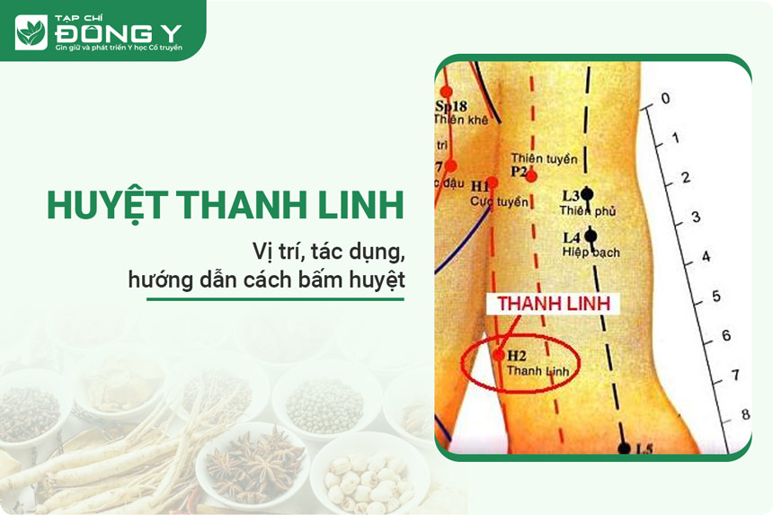 Huyệt thanh linh