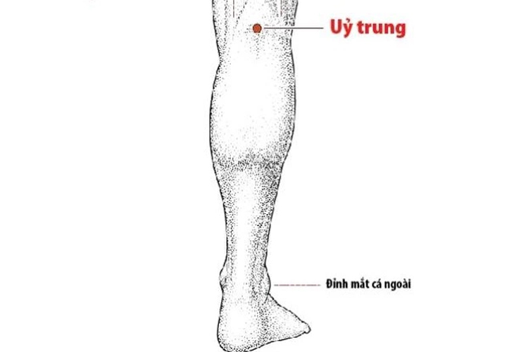 Có thể phối huyệt Ủy Trung để điều trị đái dắt, đái buốt